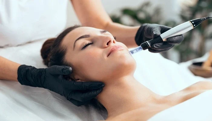 Mesotherapy vs Microneedling