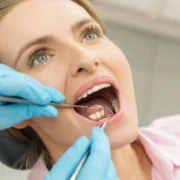 Tooth Fillings