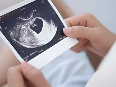 Pregnancy Ultrasound Clinic