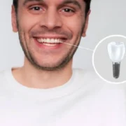 Tooth Loss