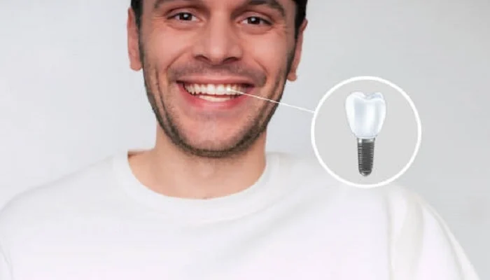 Tooth Loss