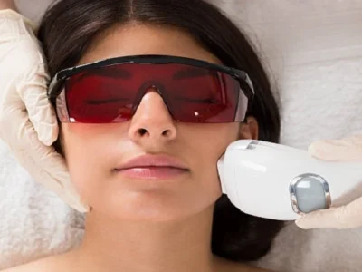 Laser Hair Removal